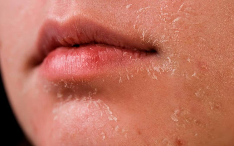 Hidratación profunda para piel seca con skincare coreano