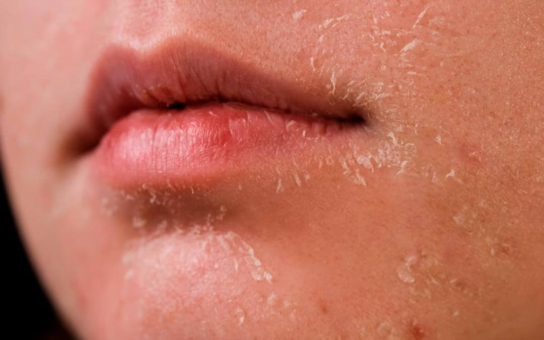 Hidratación profunda para piel seca con skincare coreano